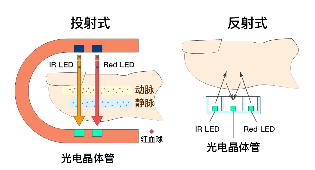 脉冲仪对身体有害吗