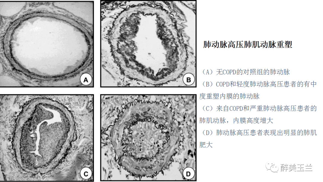 耳夹好用吗